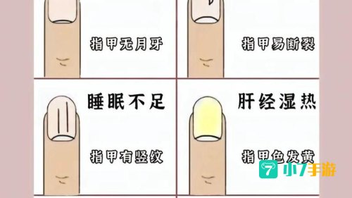 指甲上的月牙少是不健康蚂蚁庄园